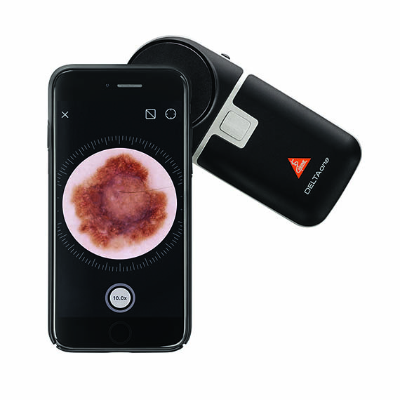 HEINE DELTAone Dermatoskop