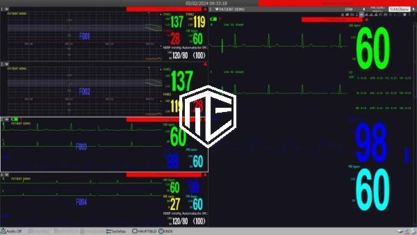 Software zu M20 Vitalzeichenmonitor